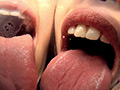[mousouzoku-5871] トリプル口臭・痰唾・痰壺・超絶激臭・究極体液摂取飲尿のキャプチャ画像 2