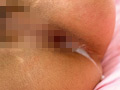 Capture-Image