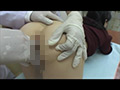【動画】医療と肛門 PART1 「肛門限界拡張診療」...thumbnai3
