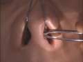 [sow-0100] 鼻毛抜き伝説2のキャプチャ画像 2