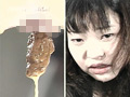 浣腸排泄総集編 10人の女の子の浣腸治療集 サンプル画像16