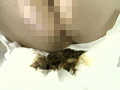 Capture-Image