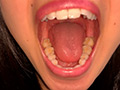 エロエロ専門トラベル科学生の歯観察 宮沢ちはる サンプル画像2