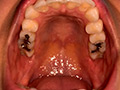 [yacchiman-0016] エロエロ専門トラベル科学生の歯観察 宮沢ちはるのキャプチャ画像 3