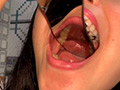 エロエロ専門トラベル科学生の歯観察 宮沢ちはる サンプル画像7