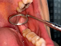 エロエロ専門トラベル科学生の歯観察 宮沢ちはる サンプル画像9