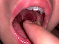 [yacchiman-0023]水沢つぐみの喉奥責め 腫れ気味な扁桃腺を…