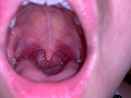 水沢つぐみの喉奥責め 腫れ気味な扁桃腺を… 画像2