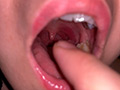 水沢つぐみの喉奥責め 腫れ気味な扁桃腺を… 画像4