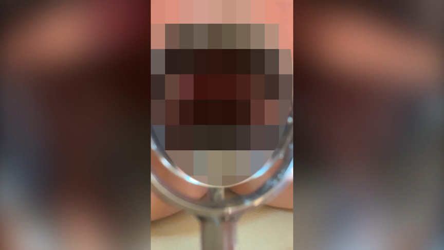 同僚のあそこにクスコぶち込んで愛液採取したった みと 画像6