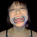【個人撮影】笠木いちかの口内観察