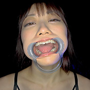 【個人撮影】笠木いちかの口内観察