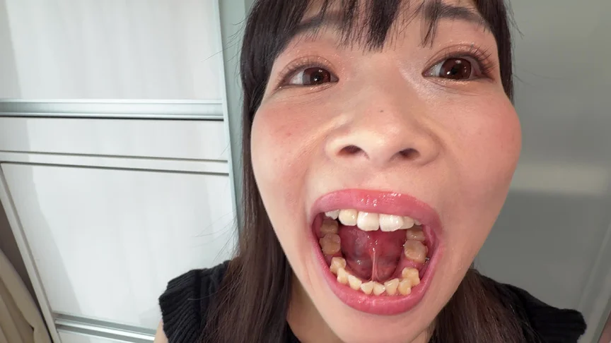 【個人撮影】原美織の舌ブラシで「汚舌苔」採取