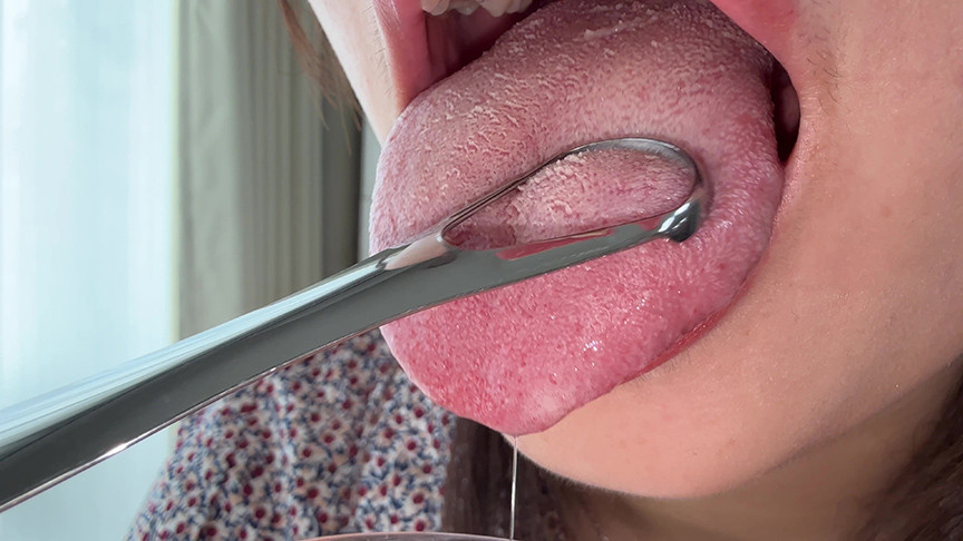 【個人撮影】水月みおの舌ブラシで「汚舌苔」採取 画像4