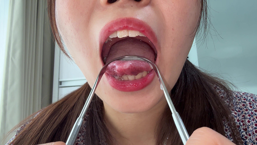 【個人撮影】水月みおの舌ブラシで「汚舌苔」採取 画像8