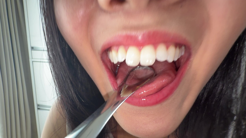 【個人撮影】桃瀬まゆの舌ブラシで「汚舌苔」採取 画像3