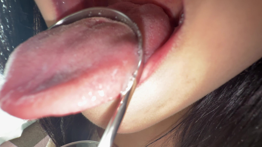 【個人撮影】桃瀬まゆの舌ブラシで「汚舌苔」採取 画像6