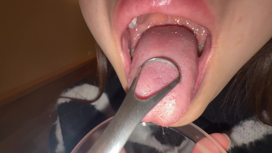 【個人撮影】さくまつなの舌ブラシで「汚舌苔」採取 画像3