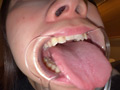 Capture-Image