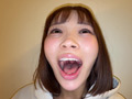 Capture-Image