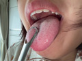 Capture-Image