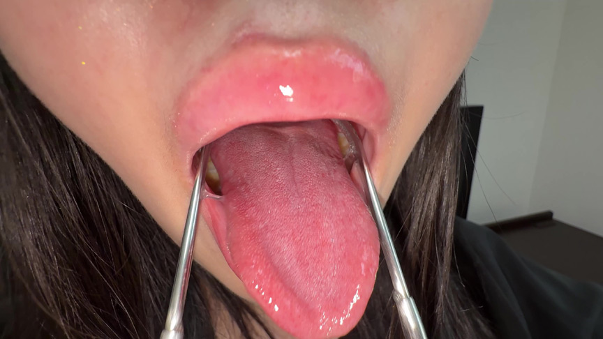 【個人撮影】ゆうきすずの舌ブラシで「汚舌苔」採取 画像5