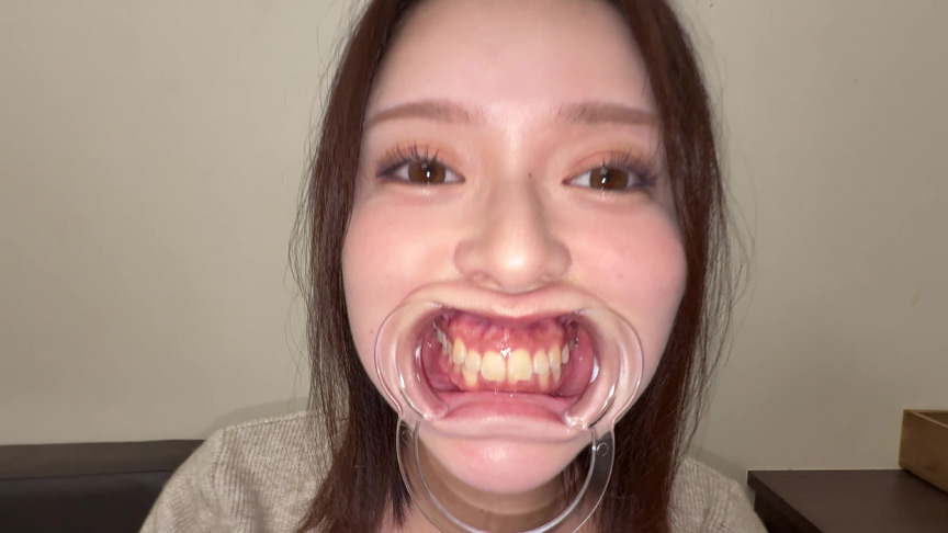 【個人撮影】彩川ゆめの喉チン触り＆開口器Wピース 画像3